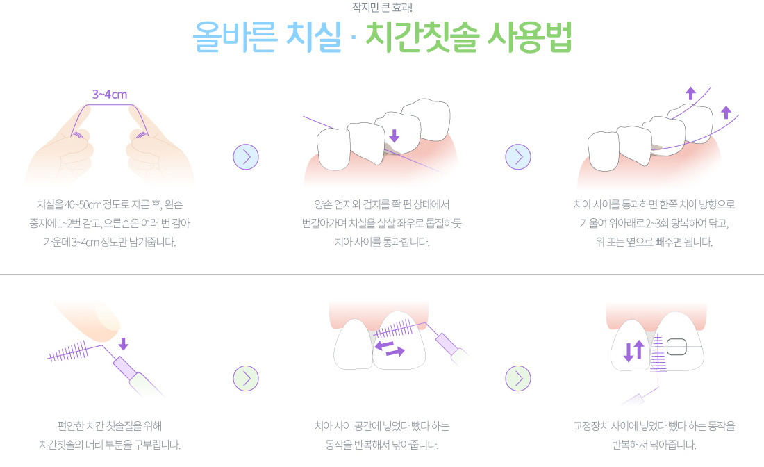 올바른 치실·치간칫솔 사용법